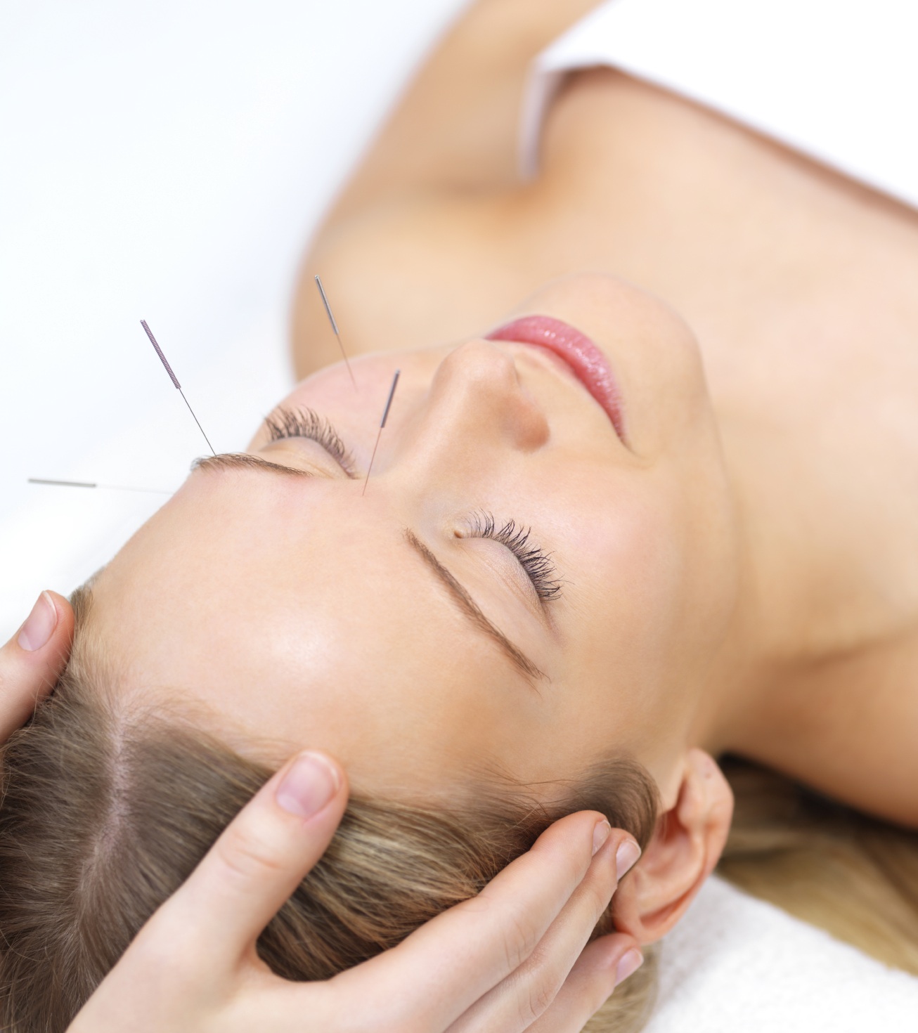 facial_acupuncture.jpg